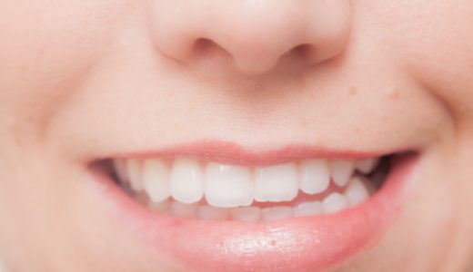 歯を白くするセルフホワイトニングの施術の流れ